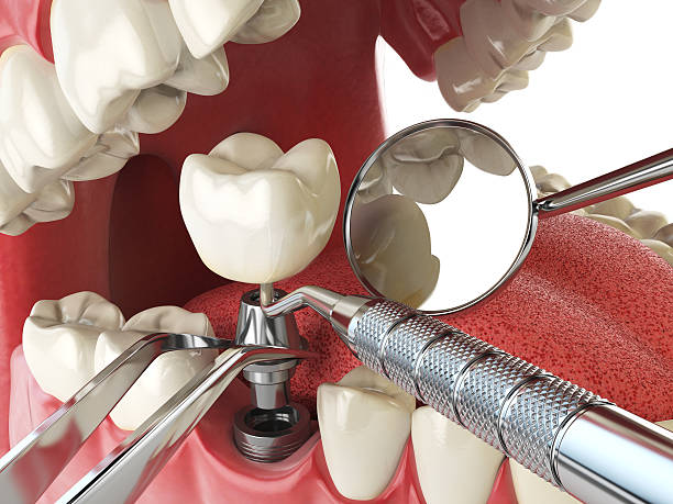 Best Emergency Dental Surgery in Springtown, TX